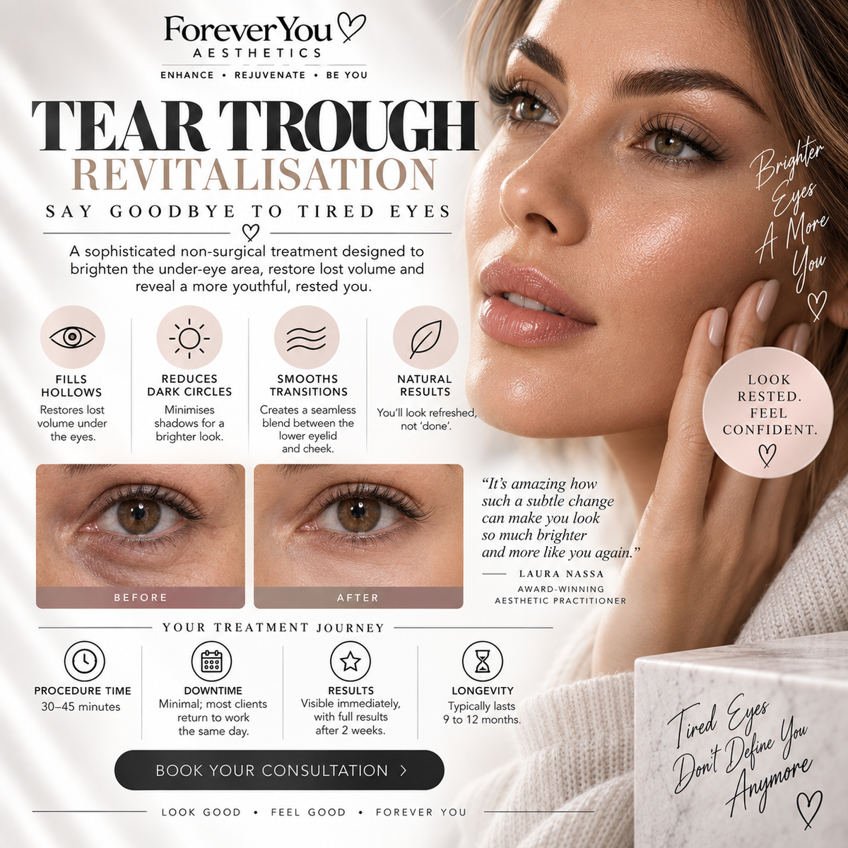 Tear Trough Filler 1ml