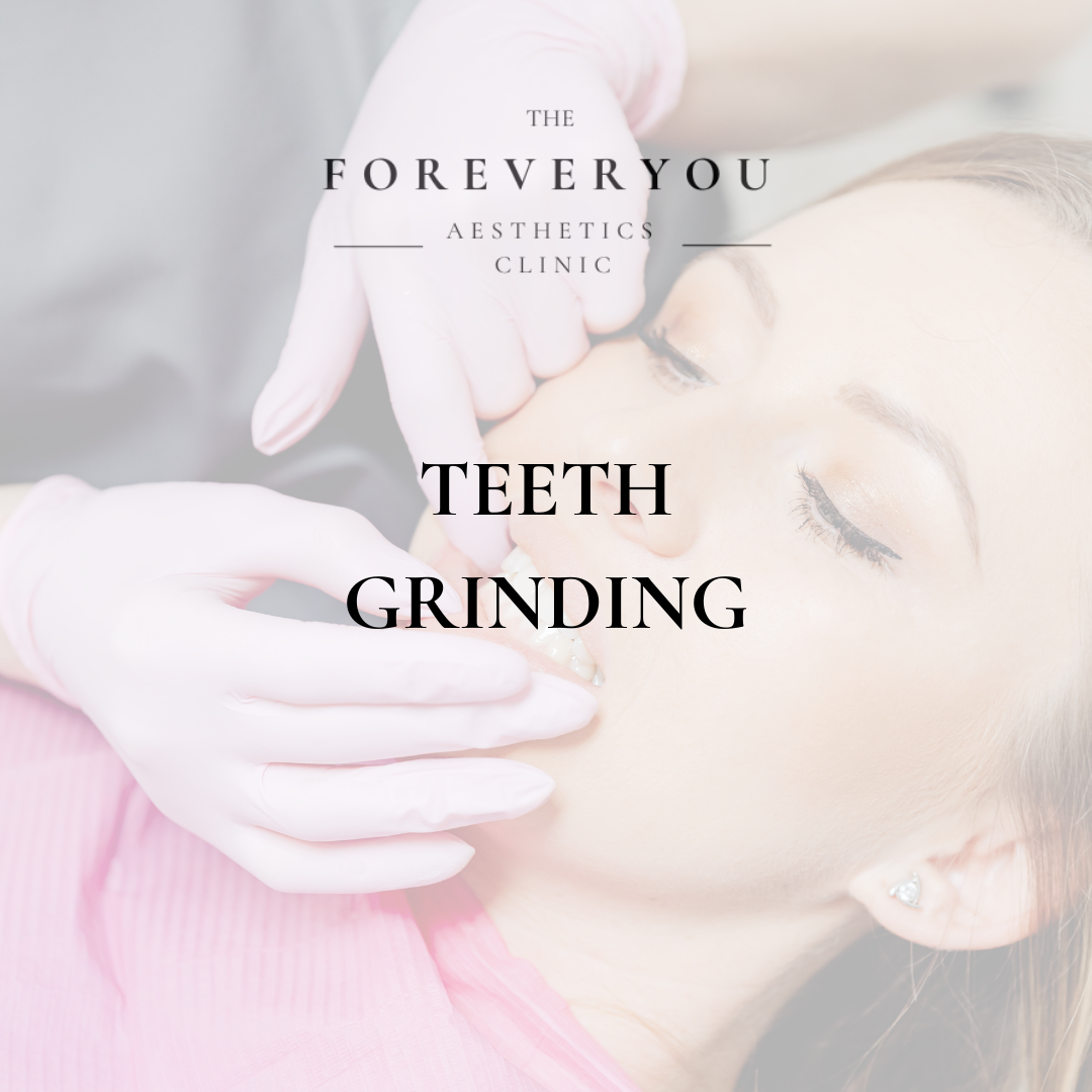 Teeth Grinding - Jaw Clenching (Masseter Botox)