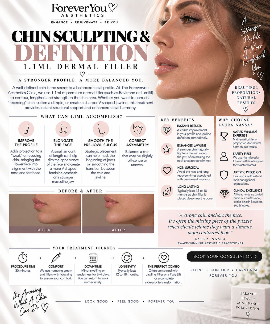 Chin Filler 1.1ml