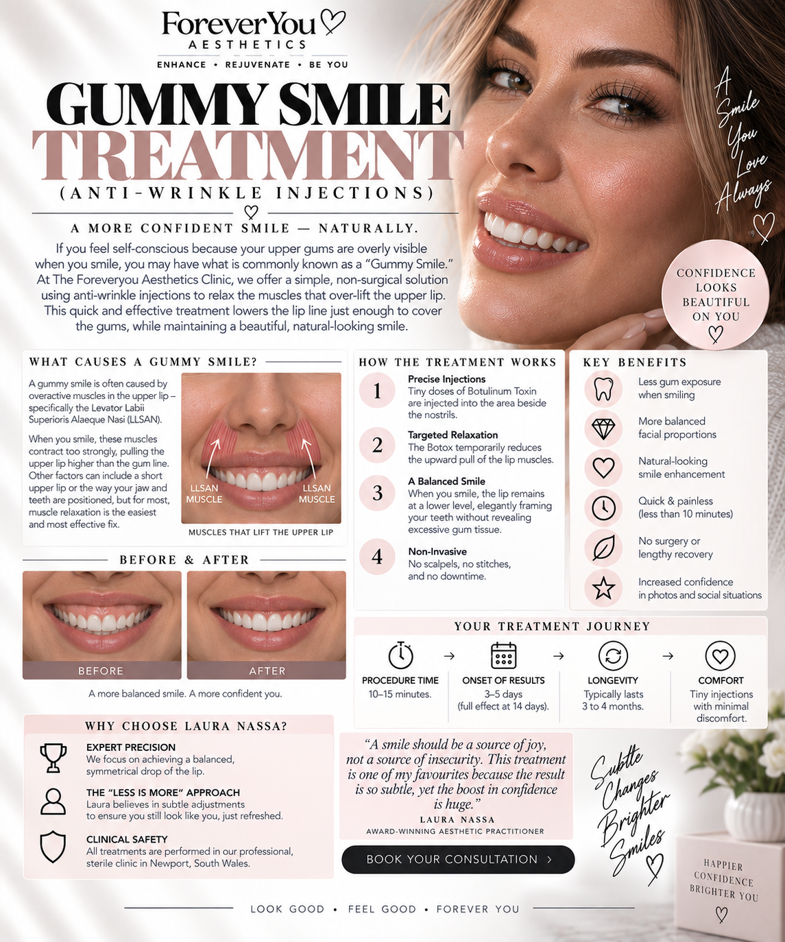 Gummy Smile