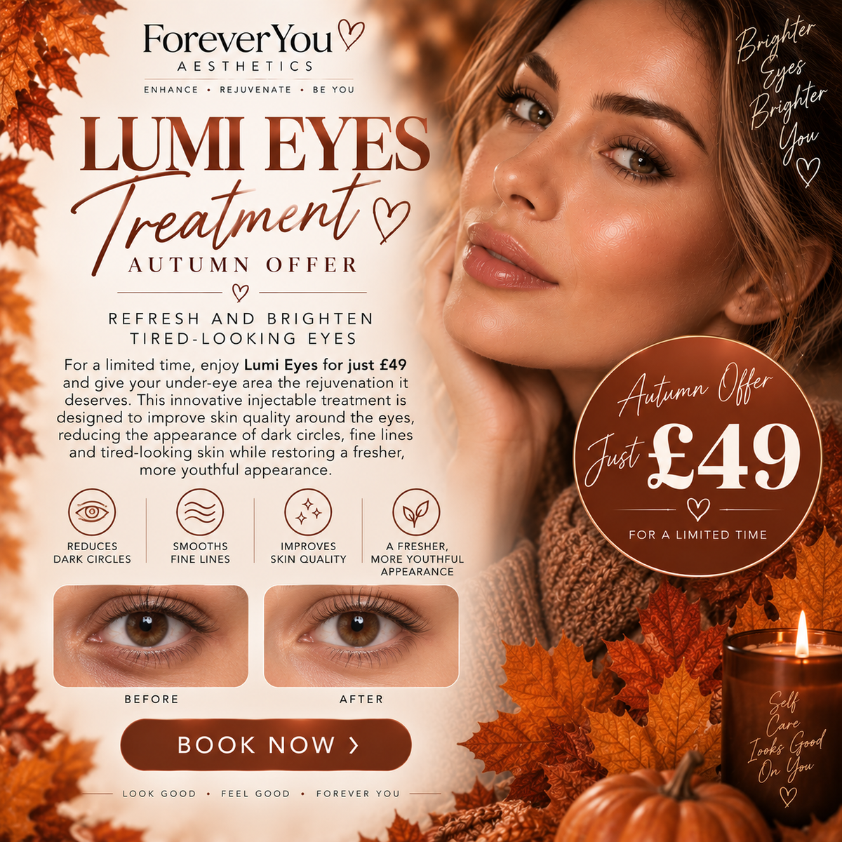Lumi Eye