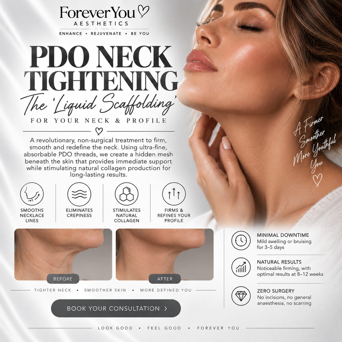 PDO Neck Tightening