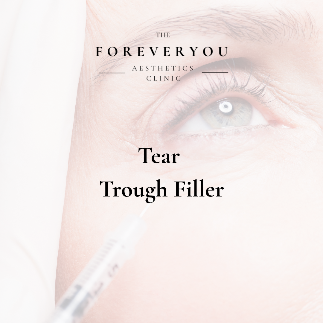 Tear Trough Filler 1ml