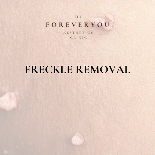 Freckle Removal