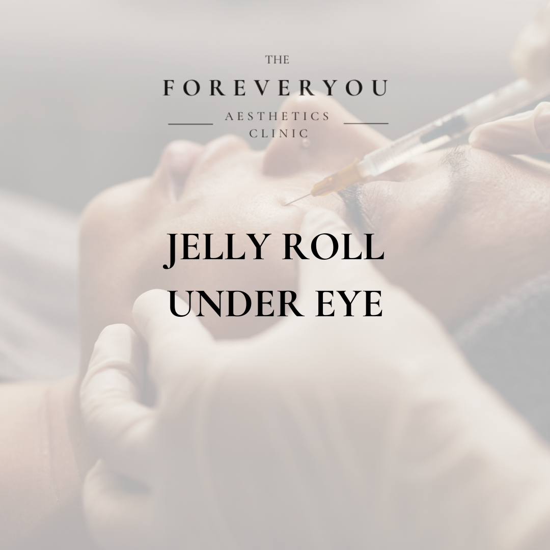 Jelly Roll- Under eye