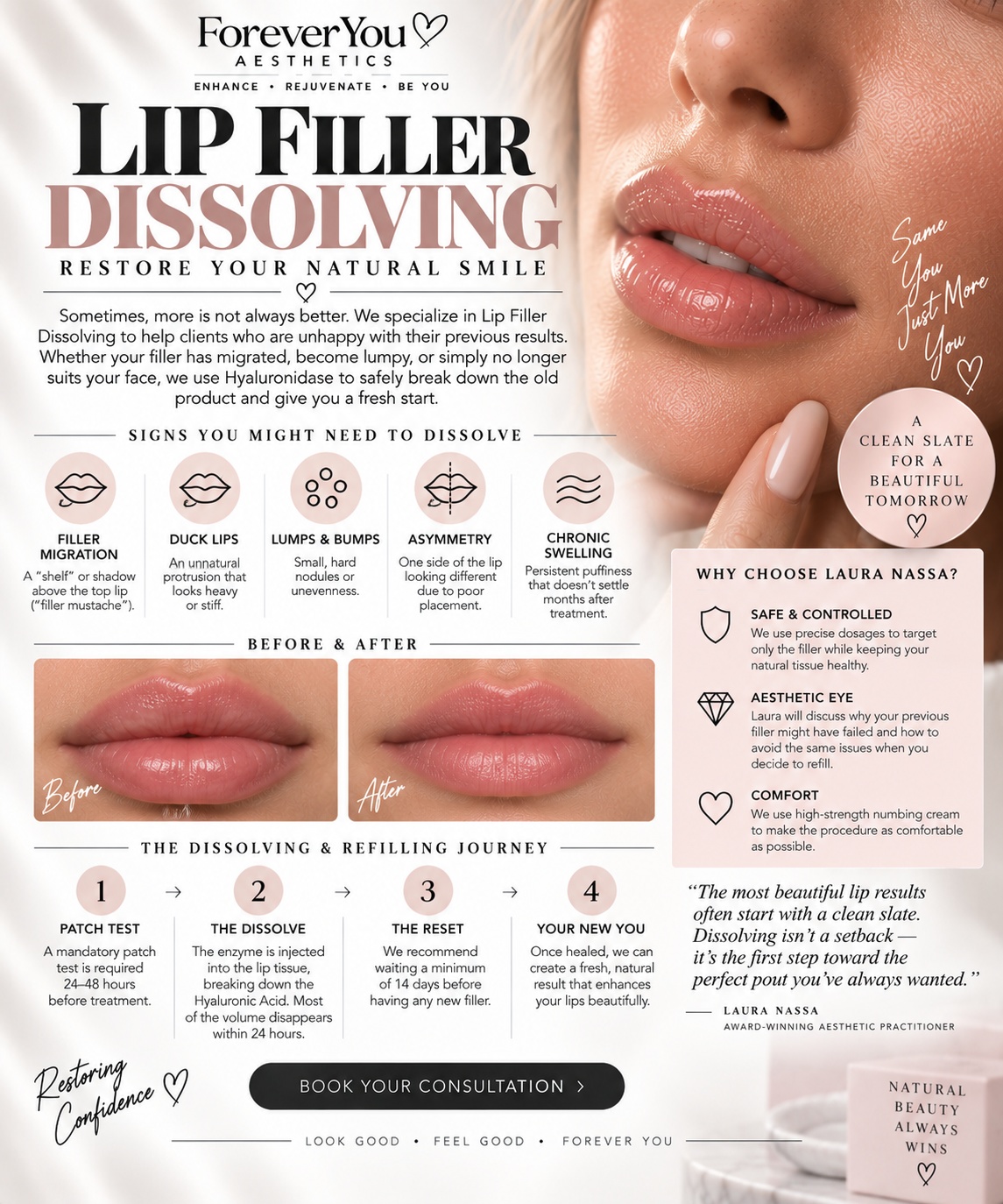 Lip Dissolve (Consultation)