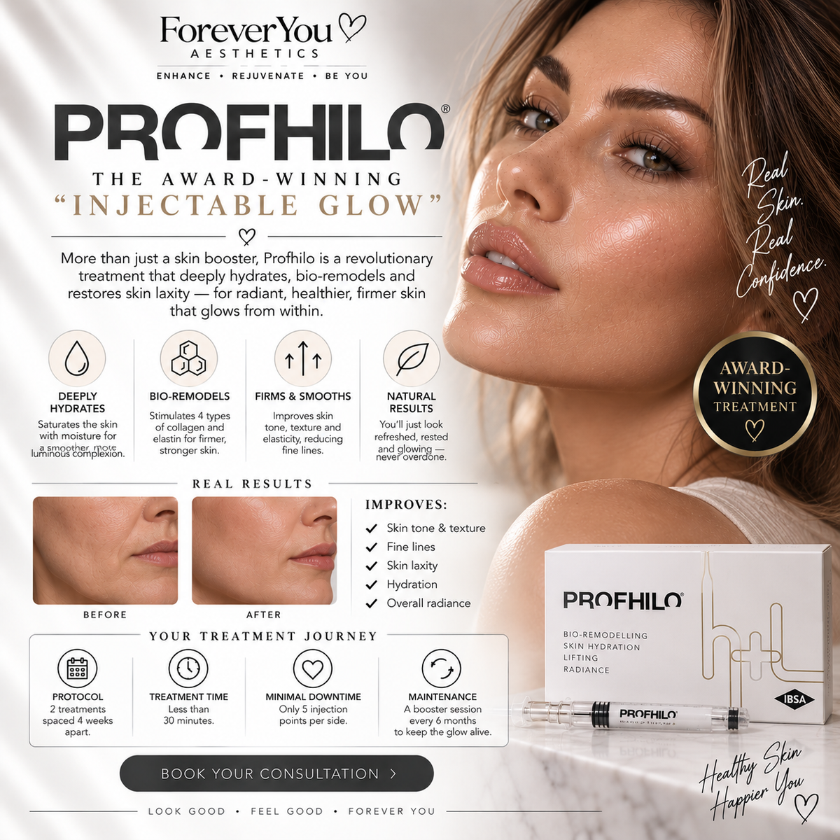 Profhilo