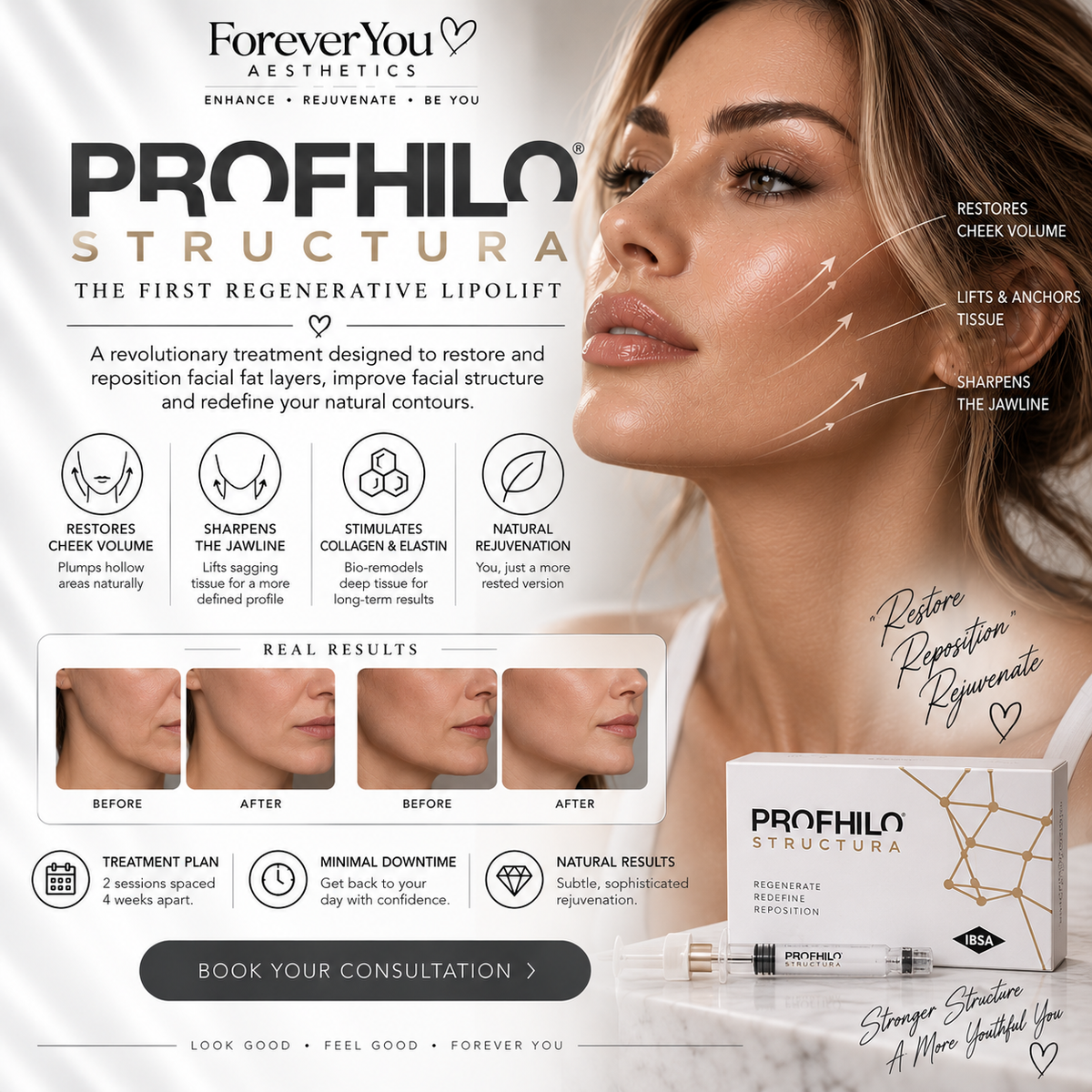 Profhilo Structura