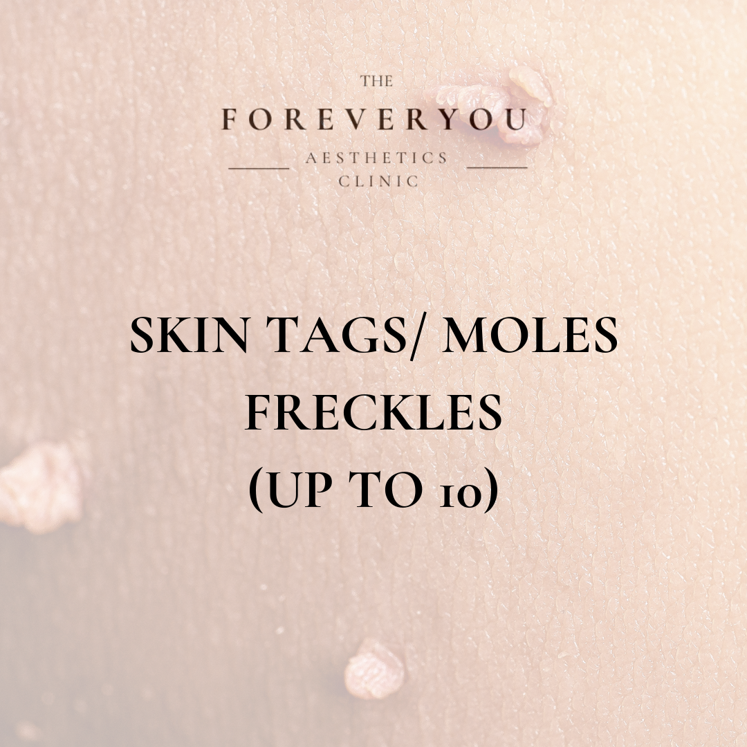 Skin Tags/ Freckle/ Moles and Age Spots Removal (Up To 10)