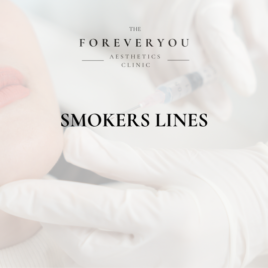 Smokers Lines