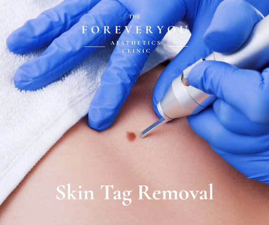 Skin Tag/ Mole Removal