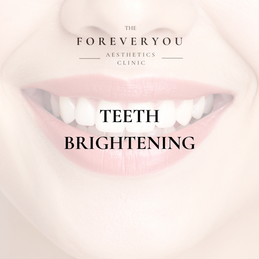 Teeth Brightening 30 minute treatment