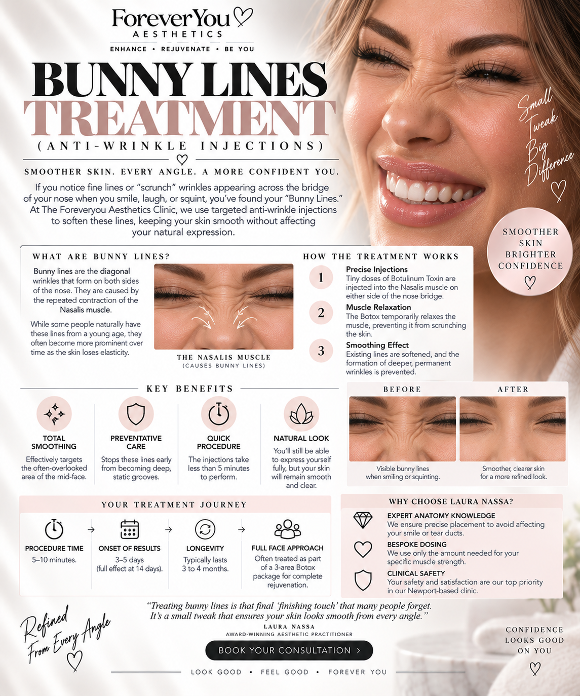 Bunny Lines