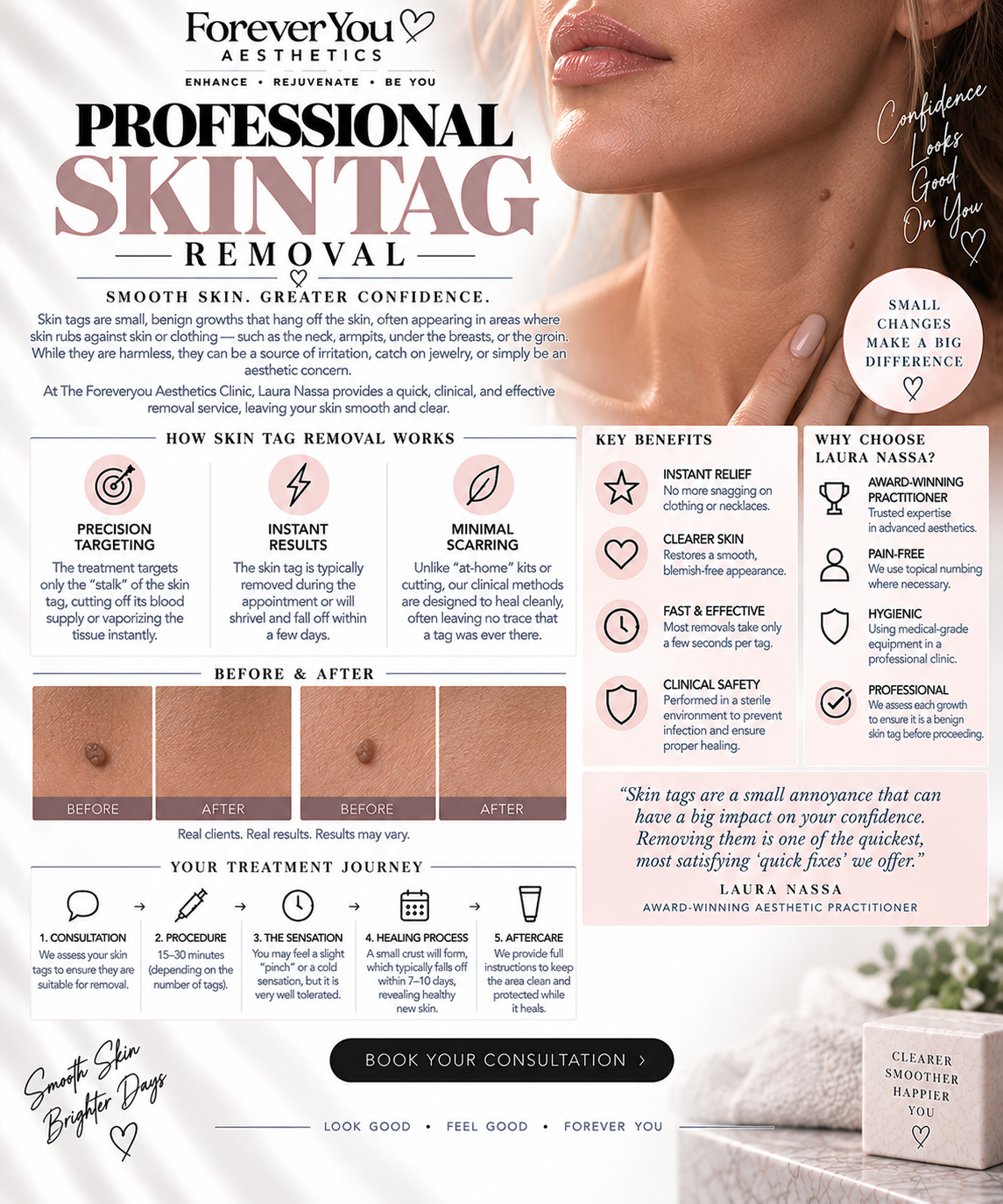Skin Tag/Mole Removal